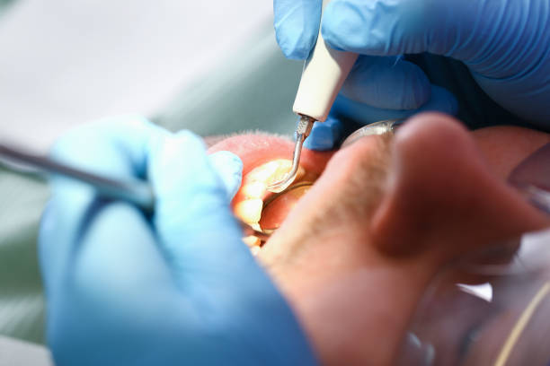 Best Emergency Care for Gum Disease in Thomasville, GA